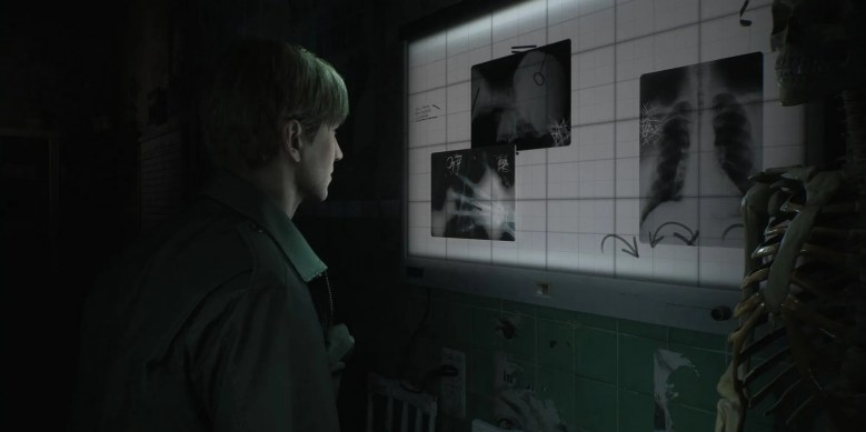 james looking at x-rays in the silent hill 2 remake