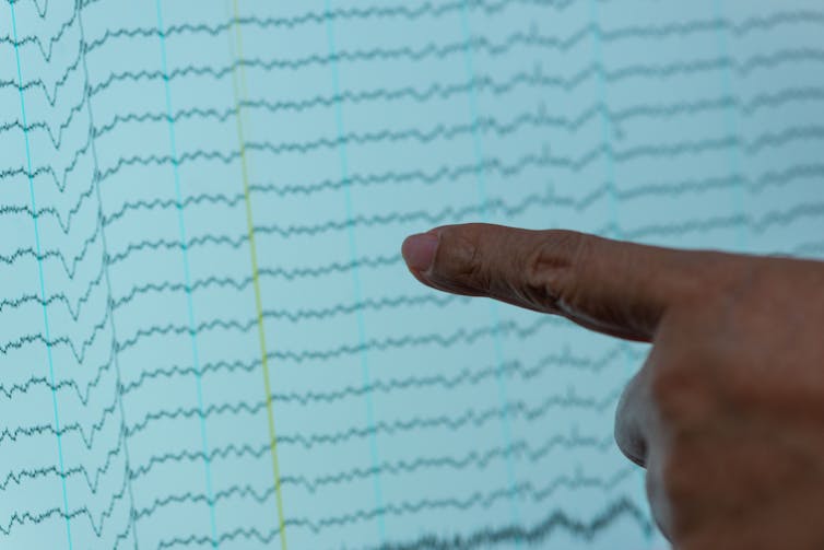 توجيه الإصبع في قراءة EEG