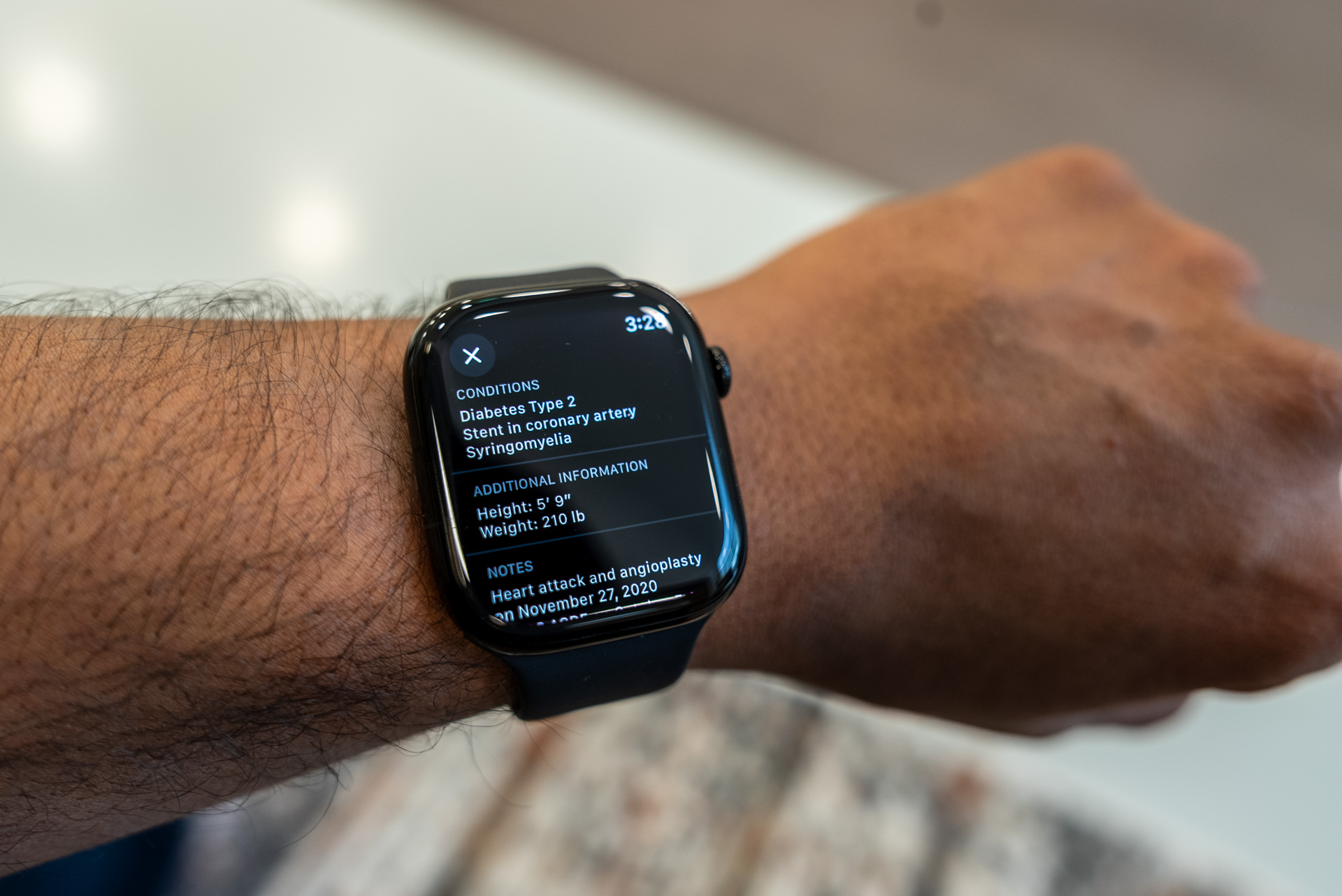 المعرف الطبي الحيوي على سلسلة Apple Watch 10